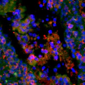 Anti-EGF(mouse) antibody used in Immunohistochemistry. GTX60321