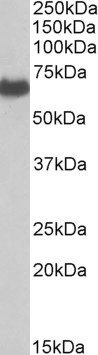 Anti-EHD2 antibody, C-term used in Western blot. GTX89668