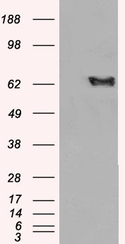 Anti-EHD2 antibody, C-term used in Western blot. GTX89668