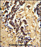 Anti-EHD3 antibody, Internal used in IHC (Formalin-fixed paraffin-embedded sections). GTX81435