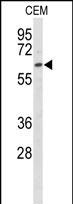 Anti-EHD3 antibody, Internal used in Western blot. GTX81435