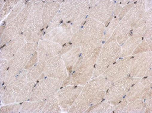 Anti-EHF antibody used in IHC (Formalin-fixed paraffin-embedded sections). GTX116440