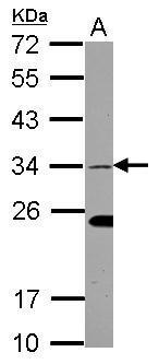 Anti-EHF antibody used in Western blot. GTX116440