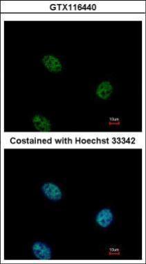 Anti-EHF antibody used in ICC/IF. GTX116440
