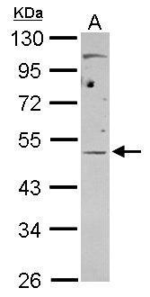 Anti-EIF4A3 antibody used in Western blot. GTX115290
