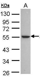 Anti-Alcohol dehydrogenase 1C antibody [N3C3] used in Western blot. GTX101375