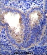 Anti-EIF5AL1 antibody used in Immunohistochemistry. GTX53548