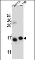 Anti-EIF5AL1 antibody used in Western blot. GTX53548