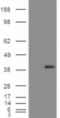 Anti-Aldehyde Reductase antibody, C-term used in Western blot. GTX11802