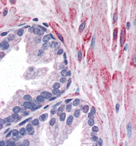 Anti-ELMO2 antibody, C-term used in IHC (Formalin-fixed paraffin-embedded sections). GTX89956