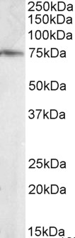 Anti-ELMO3 antibody, C-term used in Western blot. GTX89943