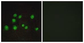Anti-ELOA2 antibody used in ICC/IF. GTX87235