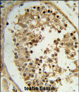 Anti-ELOVL2 antibody, N-term used in IHC (Formalin-fixed paraffin-embedded sections). GTX80506