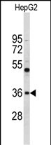 Anti-ELOVL2 antibody, N-term used in Western blot. GTX80506