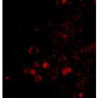 Anti-ELOVL6 antibody used in ICC/IF. GTX85403