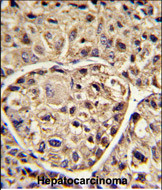 Anti-ELOVL6 antibody, N-term used in IHC (Formalin-fixed paraffin-embedded sections). GTX81872
