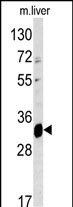 Anti-ELOVL6 antibody, N-term used in Western blot. GTX81872