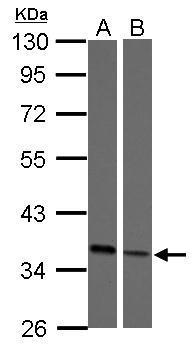 Anti-EMB antibody [N3C3] used in Western blot. GTX121952