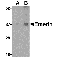 Anti-Emerin antibody used in Western blot. GTX85058