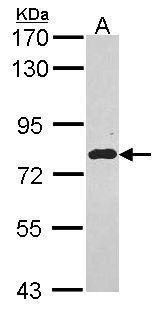 Anti-EML1 antibody [C2C3], C-term used in Western blot. GTX114382