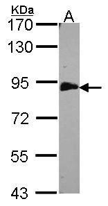 Anti-EML1 antibody [C3], C-term used in Western blot. GTX100252