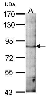 Anti-EML1 antibody [C3], C-term used in Western blot. GTX100252
