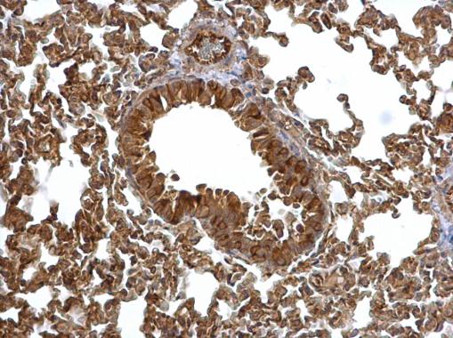 Anti-EML1 antibody [C3], C-term used in IHC (Formalin-fixed paraffin-embedded sections). GTX100252