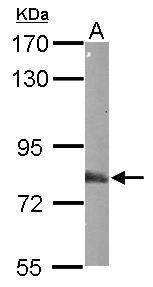 Anti-EML1 antibody [N1N3] used in Western blot. GTX114381