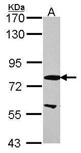 Anti-EML1 antibody [N1N3] used in Western blot. GTX114381