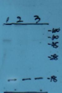 Anti-Emp1 antibody used in Western blot. GTX37707