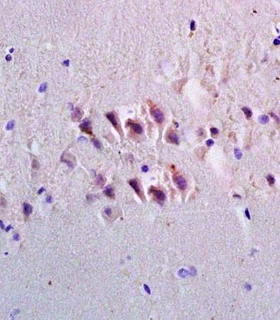Anti-Emp1 antibody used in IHC (Formalin-fixed paraffin-embedded sections). GTX37707
