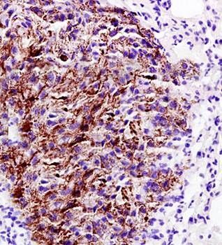Anti-Emp1 antibody used in IHC (Formalin-fixed paraffin-embedded sections). GTX37707