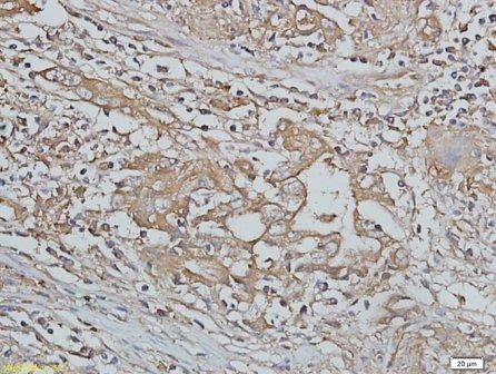 Anti-Emp1 antibody used in IHC (Formalin-fixed paraffin-embedded sections). GTX37707