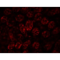 Anti-ENC-1 antibody used in ICC/IF. GTX85108