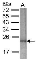 Anti-ENDOD1 antibody [N2C2], Internal used in WB-Ag. GTX122953