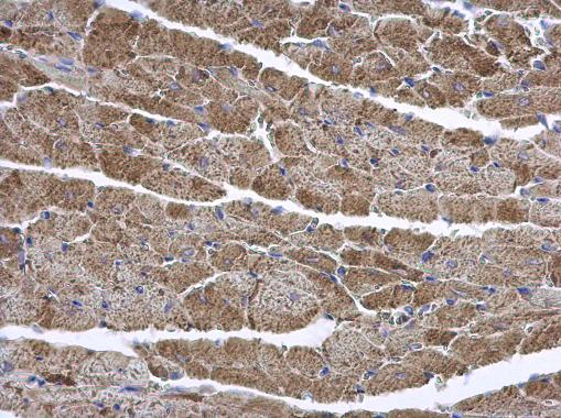 Anti-ENTPD6 antibody [N1C1] used in IHC (Formalin-fixed paraffin-embedded sections). GTX101851
