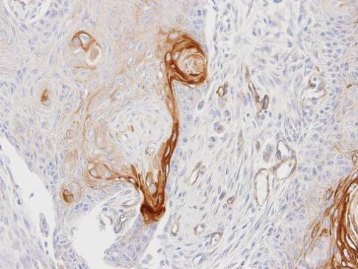 Anti-ENTPD6 antibody [N1C1] used in IHC (Formalin-fixed paraffin-embedded sections). GTX101851