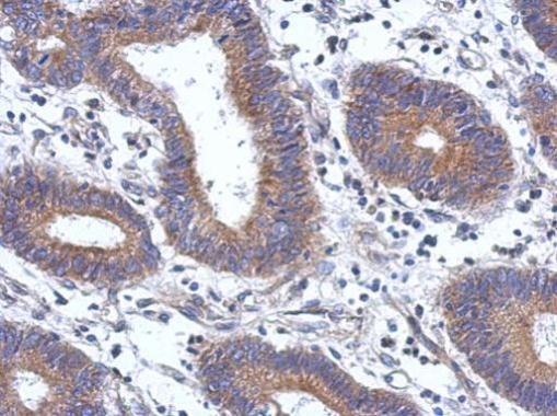 Anti-ENTPD7 antibody [N1N3] used in IHC (Formalin-fixed paraffin-embedded sections). GTX120593