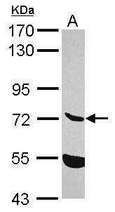 Anti-ENTPD7 antibody [N1N3] used in Western blot. GTX120593