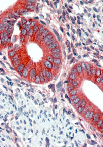 Anti-EPB41L2 (aa 347 to 357) antibody, Internal used in IHC (Formalin-fixed paraffin-embedded sections). GTX88899