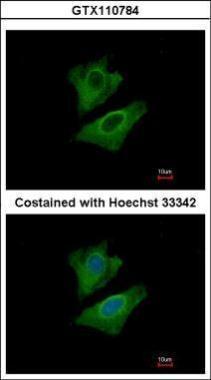 Anti-ALDH1A3 antibody [N2C2], Internal used in ICC/IF. GTX110784