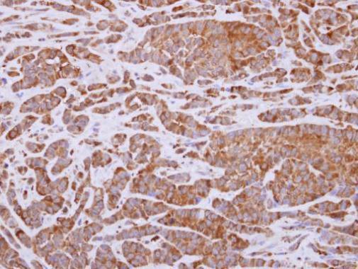 Anti-ALDH1A3 antibody [N2C2], Internal used in IHC (Formalin-fixed paraffin-embedded sections). GTX110784
