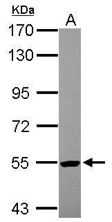 Anti-ALDH1A3 antibody [N2C2], Internal used in Western blot. GTX110784