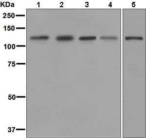 Anti-EphB1 antibody [EPR6457] used in Western blot. GTX63977