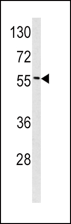 Anti-EPN3 antibody, N-term used in Western blot. GTX81869