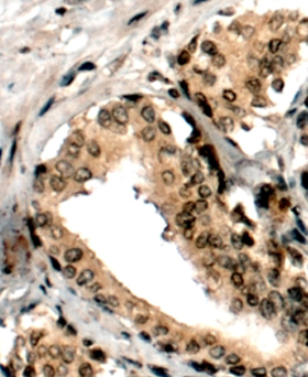 Anti-ERG antibody, C-term used in IHC (Formalin-fixed paraffin-embedded sections). GTX89421