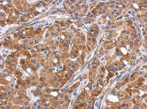 Anti-ERLIN1 antibody used in IHC (Formalin-fixed paraffin-embedded sections). GTX120815