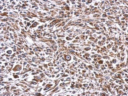 Anti-ERLIN1 antibody used in IHC (Formalin-fixed paraffin-embedded sections). GTX120815
