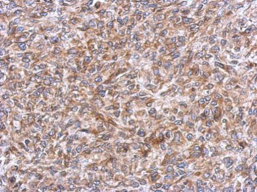 Anti-ERLIN1 antibody used in IHC (Formalin-fixed paraffin-embedded sections). GTX120815