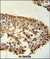 Anti-ERO1LB antibody used in Immunohistochemistry. GTX53598